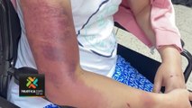 tn7-Fotografías muestran graves lesiones que sufrió oriental agredido con un tubo-120523