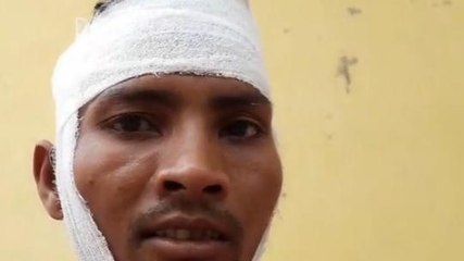 बेगूसराय: भूमि विवाद को लेकर दो पक्षों के बीच जमकर चली लाठी डंडे, महिला समेत तीन घायल