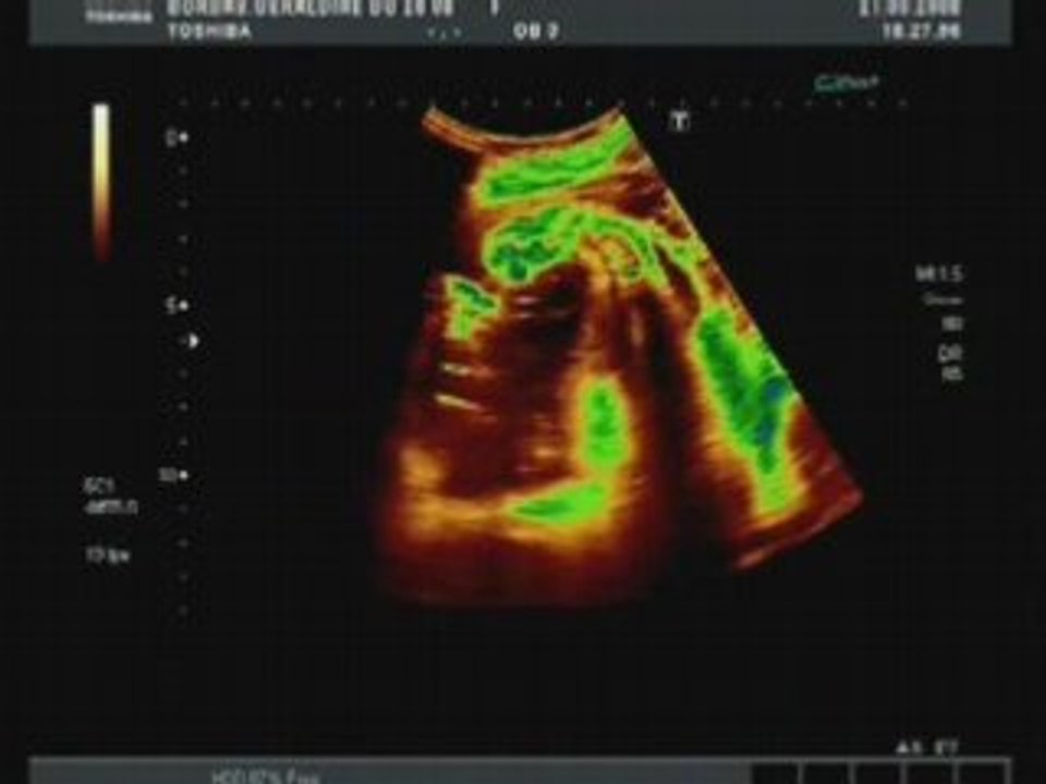 Echo 3eme trimestre redimensionné