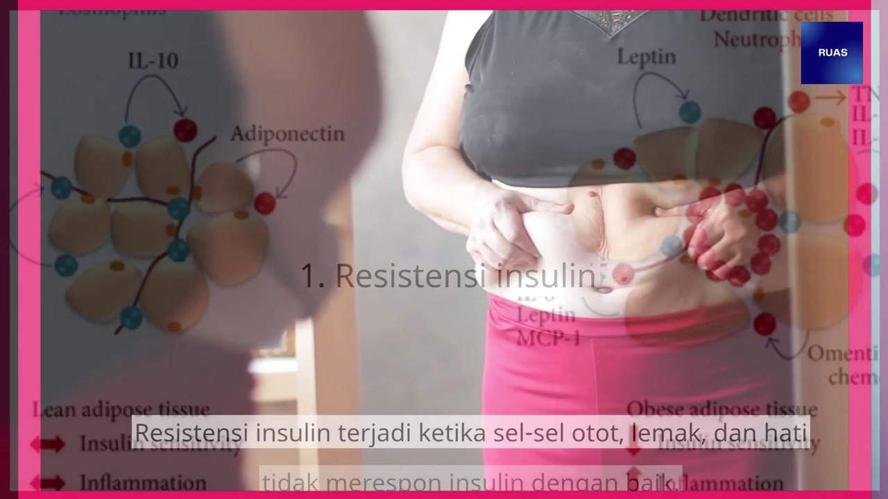 Faktor-Faktor Penyebab Diabetes Yang Anda Perlu Ketahui