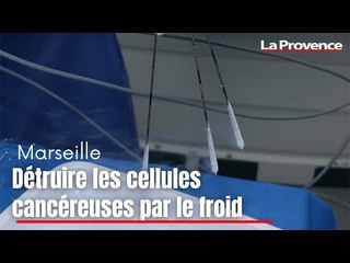 Скачать видео: Marseille : détruire les cellules cancéreuses par le froid