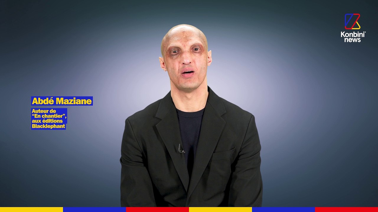 Acteur dans les caméras cachés de Greg Guillotin, Abdé Maziane est atteint de dysplasie ectodermique