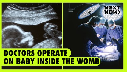Doctors operate on baby inside the womb | NEXT NOW