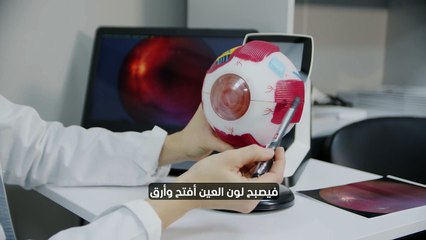 فيديو - عملية تغيير لون العيون بالليزر.. هل هي آمنة؟ - المشهد