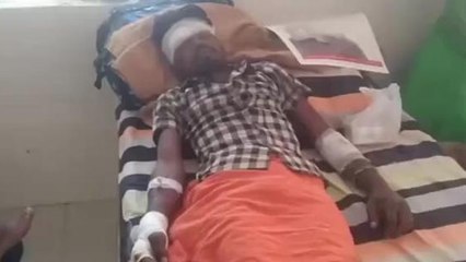 सीधी: स्पीड ब्रेकर के कारण बाइक चालक युवक हुआ दुर्घटना का हुआ शिकार