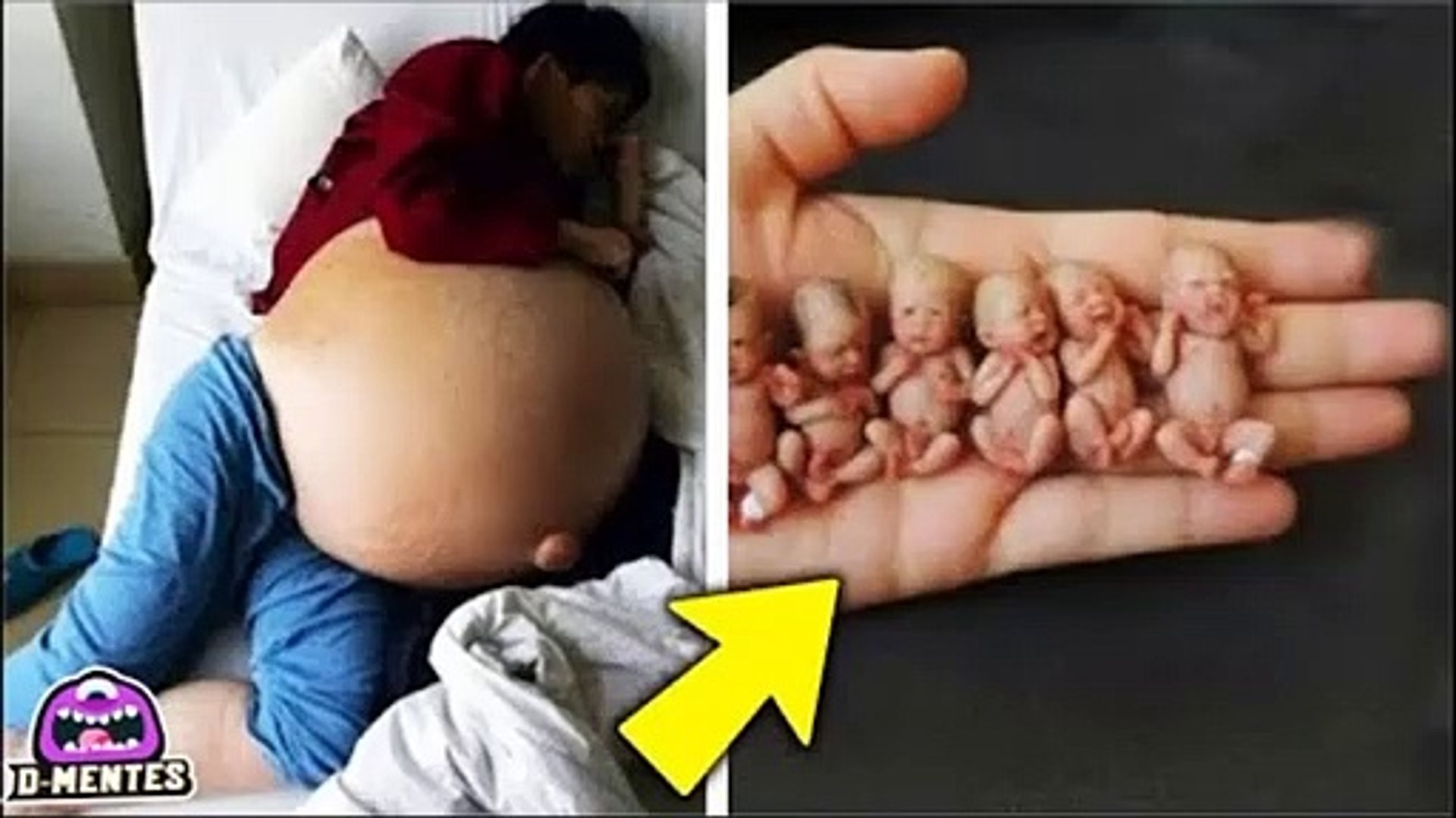 ⁣Pensó Que Estaba Embarazada de Gemelos, pero dio a luz a 11 bebes