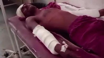 बड़वारा: डंडे से पीट-पीट कर युवक को किया गंभीर घायल