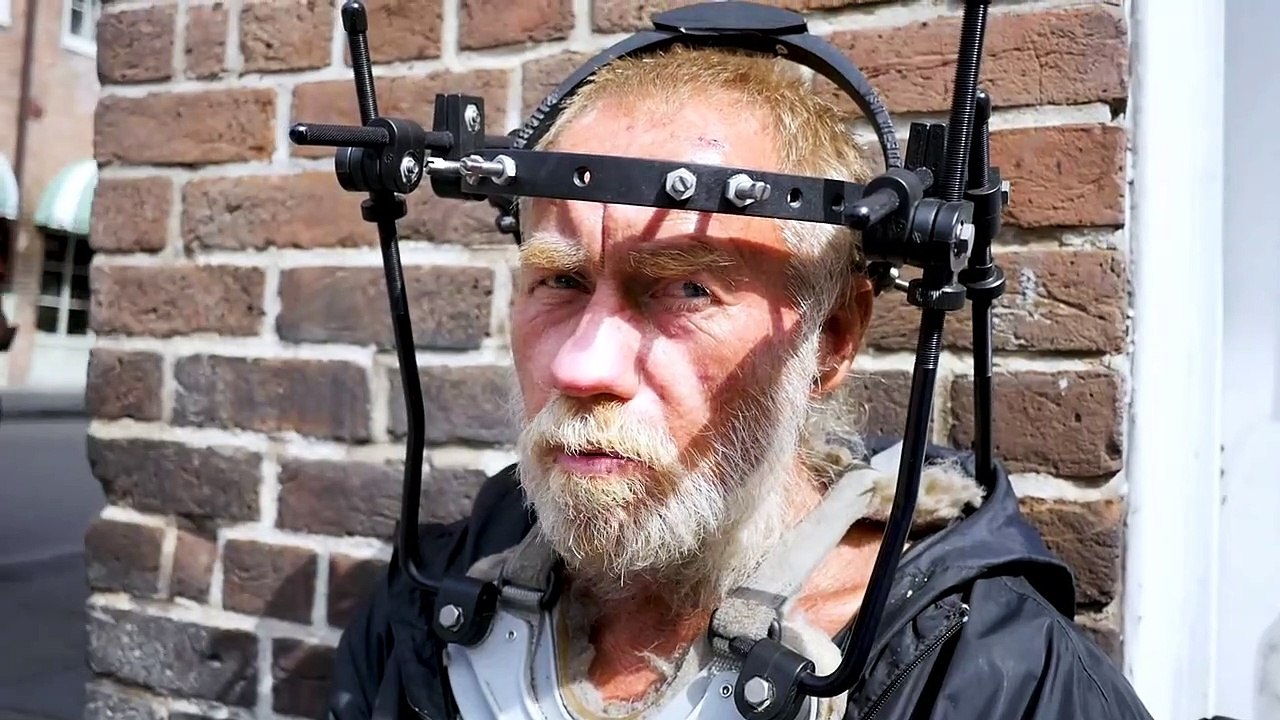 Homeless Man Recently Discharged From a Hospital