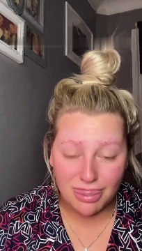 Home Brow Lamination Kit Causes Eyebrows to Fall Off