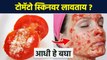 टोमॅटो स्किन वर लावण्या आधी हा व्हिडिओ बघाच | Benefits Tomato Applying Face | Skin Care Tips | AI2