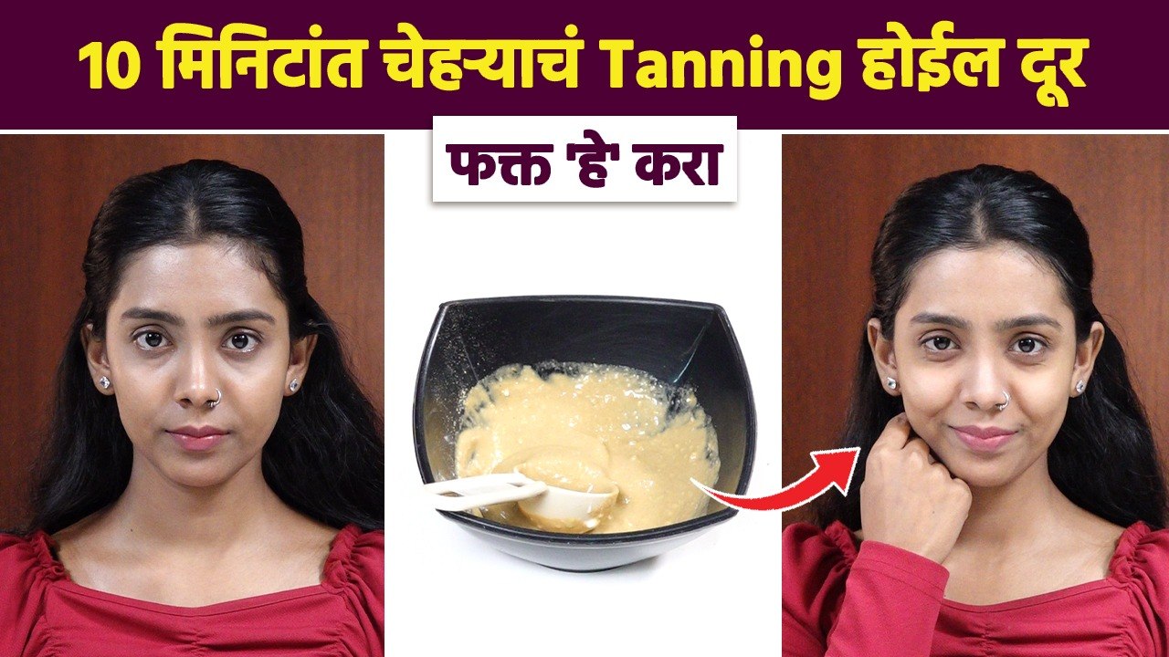 चेहरा काळवंडलाय? हा उपाय नक्की करा |Top 3 Face...
