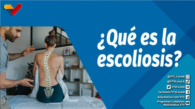 Actitud Saludable | ¿Qué es la escoliosis? Causas, síntomas, diagnóstico y tratamiento