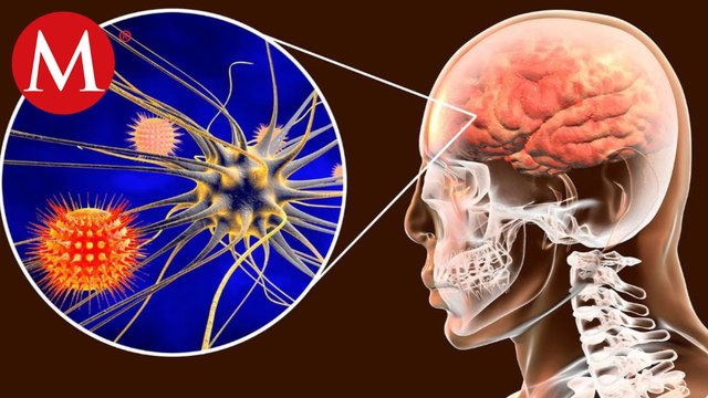 Esto sabemos sobre los posibles casos de meningitis en Tamaulipas