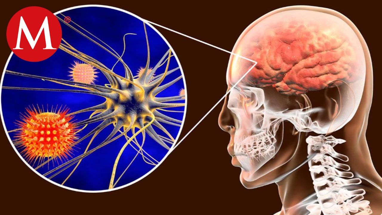 Esto sabemos sobre los posibles casos de meningitis en Tamaulipas