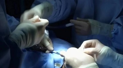 Mujer murió en procedimiento en casa fiscal de policía que funcionaría como estética ilegal