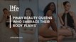 Filipina beauty queens who embrace their body 'flaws'