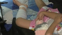 Menor atacada por un perro en Santander tuvo que ser sometida a cirugía de reconstrucción