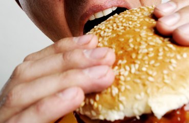 Obesity should be renamed 'chronic appetite dysregulation'