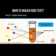 Vaaler-Rose Test Explained: Detecting Rheumatoid Arthritis 🩺