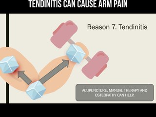 Tendinitis can cause arm pain