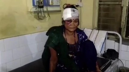 बदायूँ: दरवाजा निकालने को लेकर हुए विवाद में महिला को सरिया मारकर किया घायल