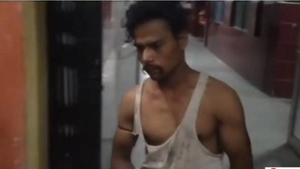 मुरादाबाद: बच्चों की कहासुनी में हुई मारपीट में युवक हुआ घायल