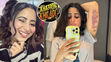KKK13: Aishwarya Sharma Cape Town में Khatron के स्टंट के दौरान हाथ पर लगी भयंकर चोट | FilmiBeat