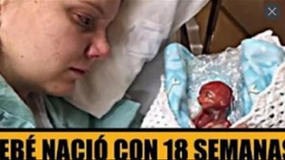 Su bebé nació a las 18 semanas – Así se lo mostró al mundo