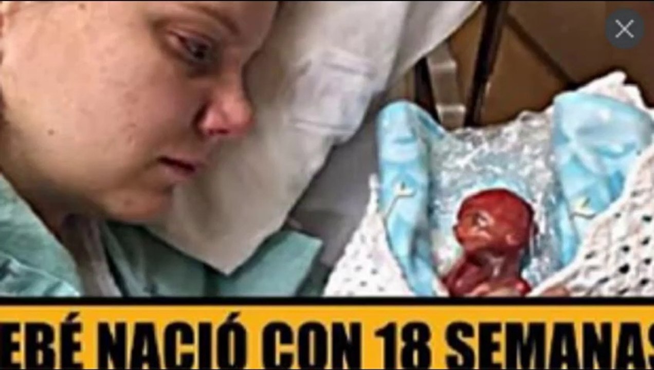 Su bebé nació a las 18 semanas – Así se lo mostró al mundo