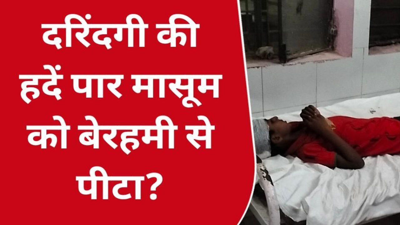 उन्नाव: मूंगफली का पौधा उखाड़ने पर खेत मालिक ने बच्चे को बेरहमी से पीटा,जांच में जुटी पुलिस