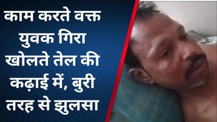 शिवपुरी: गर्म खोलते हुए तेल की कढ़ाई में जा गिरा युवक,मची अफरा तफरी