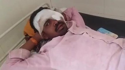 सीधी: बच्चे को बचाते वक्त दुर्घटना का शिकार हुआ बाइक सवार युवक, जारी ईलाज