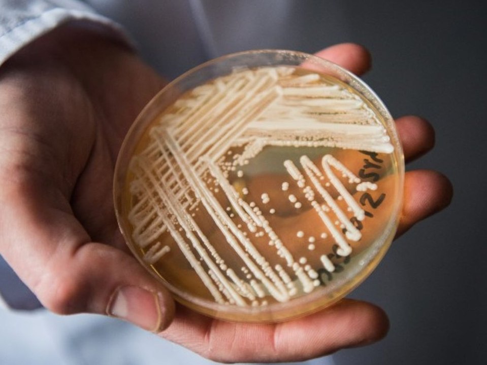 Candida Auris: Das steckt hinter der 'dringenden Bedrohung'