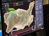 Une nouvelle technique pour les opérations cardiaques - La chaîne des territoires de Saint-Etienne Métropole - TL7, Télévision loire 7