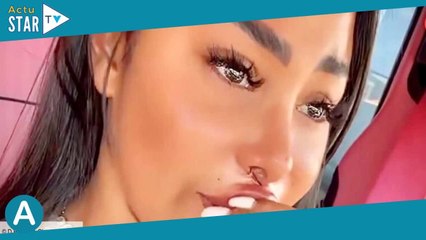 « En mode soudure » : Booba dévoile des clichés de la cicatrice nasale catastrophique de Maeva Ghenn