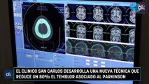 El Clínico San Carlos desarrolla una nueva técnica que reduce un 80% el temblor asociado al ParkinsonEl Clínico San Carlos desarrolla una nueva técnica que reduce un 80% el temblor asociado al Parkinson