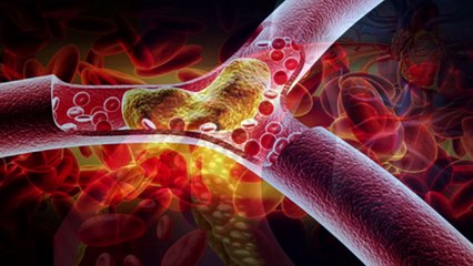 Akhrot badam khele ki hoy-akhrot badam er upokarita-pesta badamer upokarita-pesta badamer upokarita