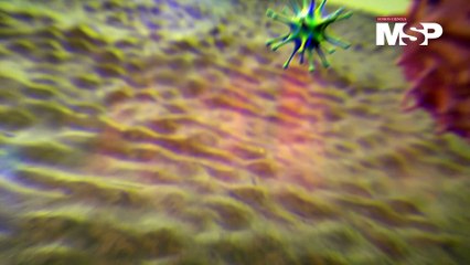 ¿Cómo Afecta el VIH al Cuerpo? Descubre su Impacto y Prevención 🦠