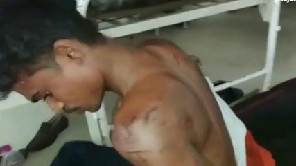 सतना: जीजा की साले ने कर दी जमकर पिटाई, लहूलुहान हालत में लाए अस्पताल