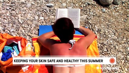 How to keep your skin sun-safe this summer