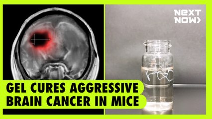 Gel cures aggressive brain cancer in mice | NEXT NOW