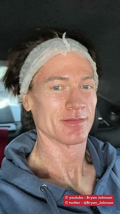 Bryan Johnson : le millionnaire qui veut rajeunir