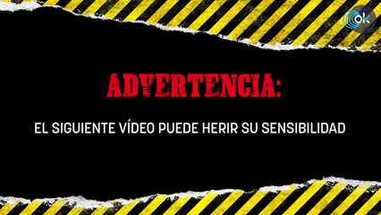 Duele sólo con mirarlo: Benzema tuvo que recibir cinco puntos tras sufrir un pisotón ante el Rayo