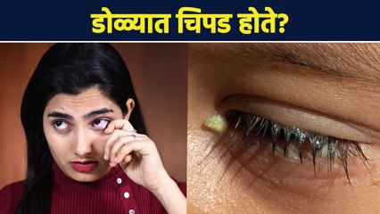डोळ्यात खूप घाण जमा होते का? | How Do You Treat Eye Gunk? | Eye Sludge | EYE Care Tips | AI2