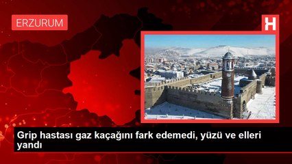 Grip hastası gaz kaçağını fark edemedi, yüzü ve elleri yandı