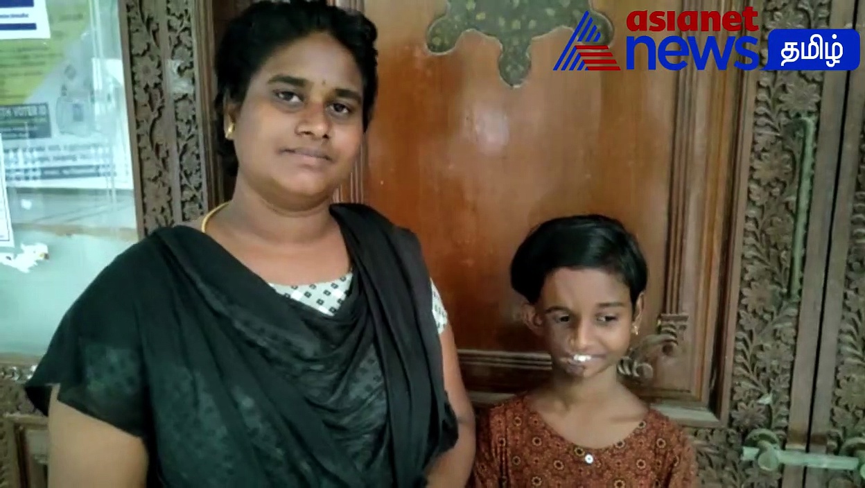 முகச்சிதைவு நோயால் பாதிக்கப்பட்ட சிறுமிக்கு தாடி பாலாஜி கொடுத்த வேறலெவல் சர்ப்ரைஸ்