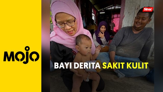 Bayi lapan bulan derita penyakit kulit, usus, lidah pendek