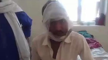 सीधी: साइकिल व मोबाइल को लेकर हुए विवाद में एक व्यक्ति के साथ की मारपीट