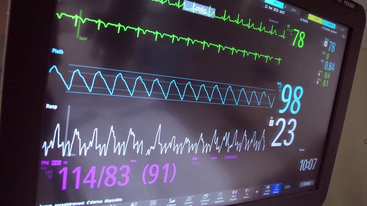 Don d'organes : un projet de loi sur le consentement présumé au N-B