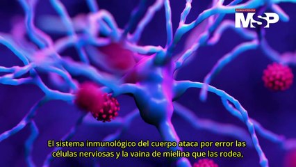 ¿Qué es la Enfermedad de Guillain-Barré? - #ExclusivoMSP